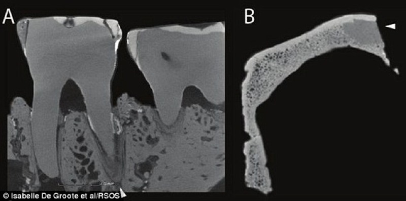 CT scans showing the presence of a dental putty used to piece together the fake specimen. (Image: De Groote et al/RSOS)